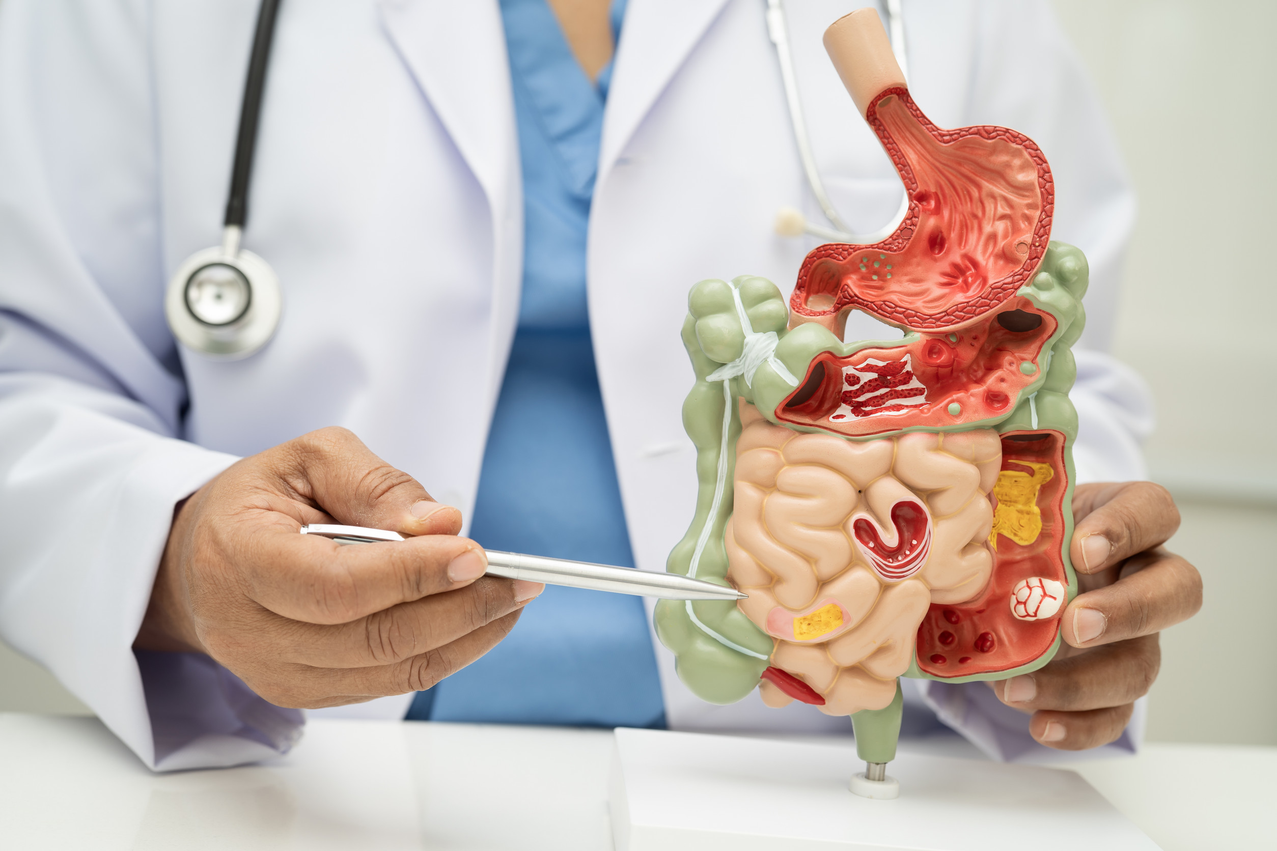 Key Health Benefits of Eating Fermented Foods