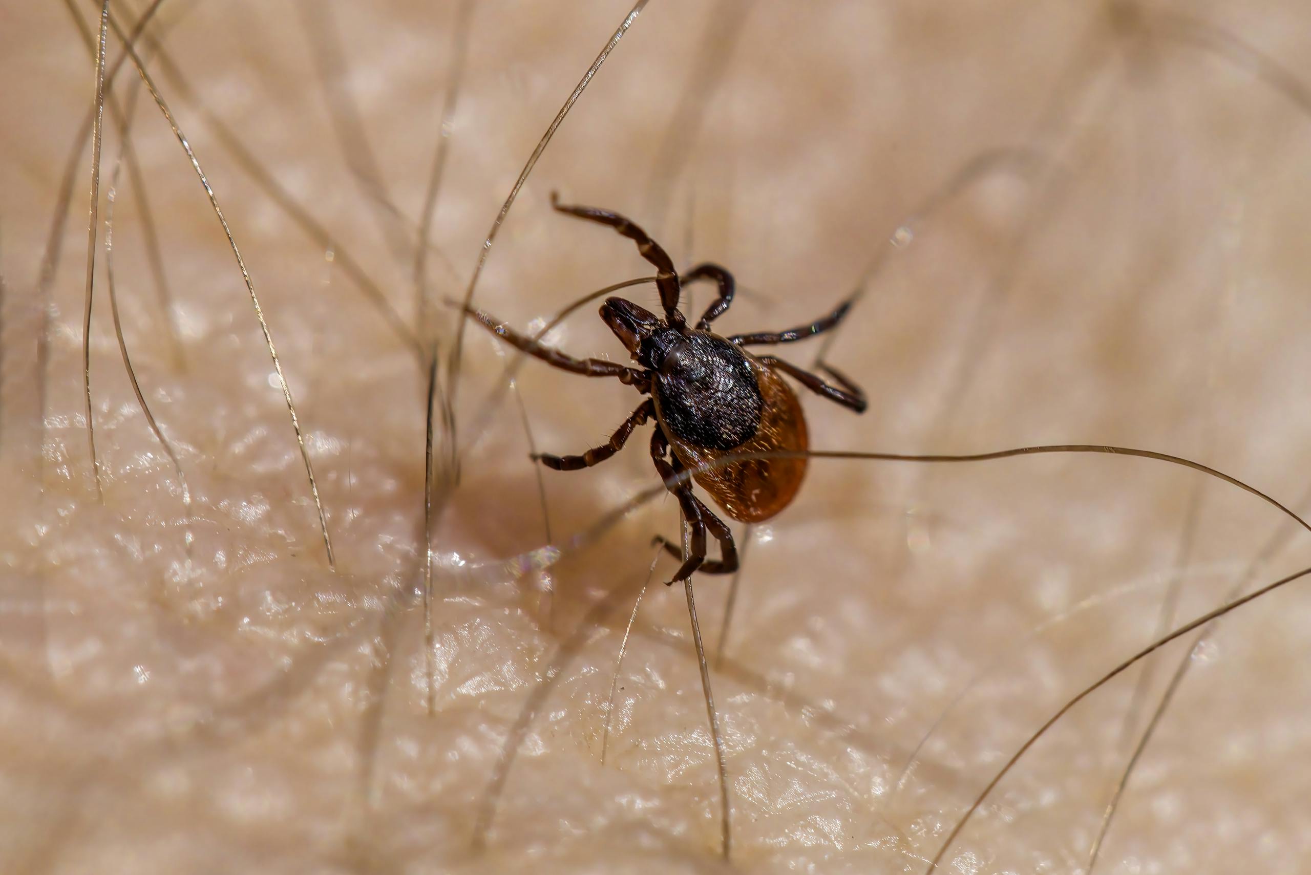 Close-up image of an Ixodes ricinus tick on human skin, illustrating its potential health risks.
